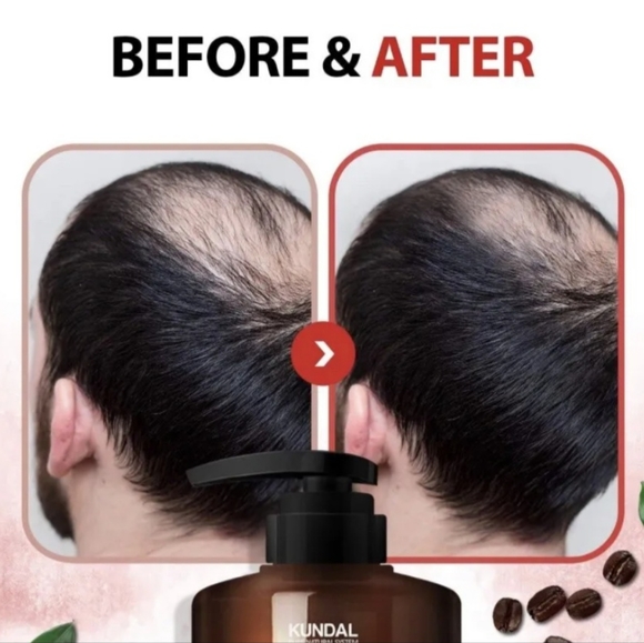 NEW KUNDAL CAFFEINE ANTI-HAIR LOSS SHAMPOO Scalp Care Deep Cleansing white musk - Picture 5 of 7